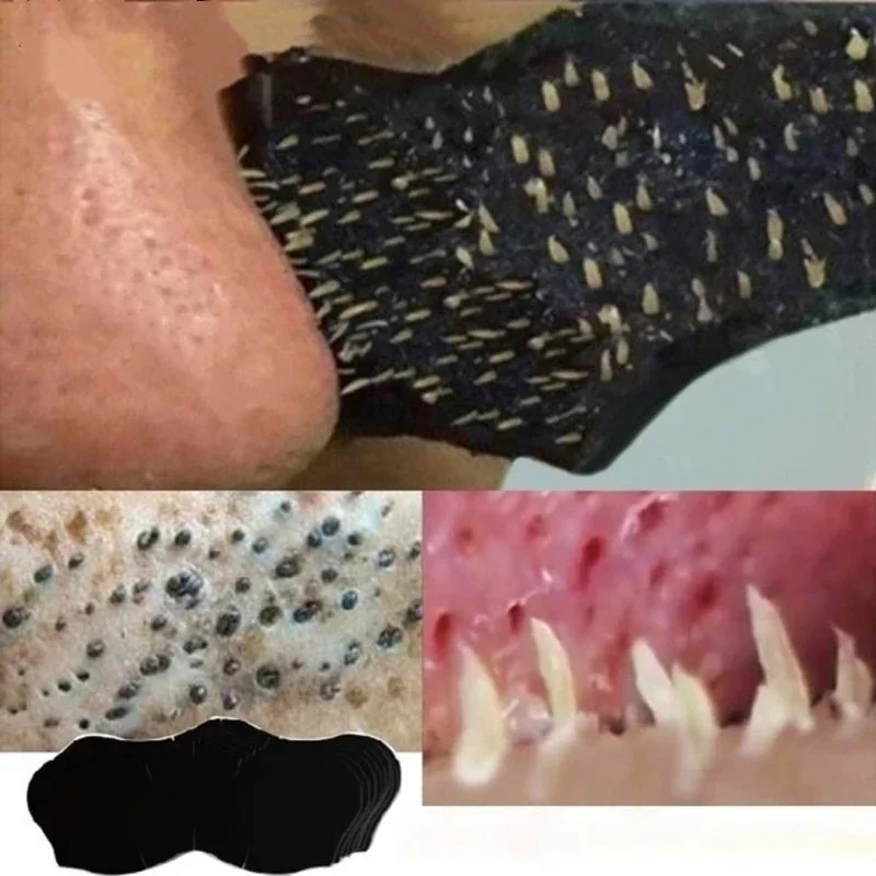 Charcoal Pore Strip - 10 PC/50 PC100 PC Blackhead Nose