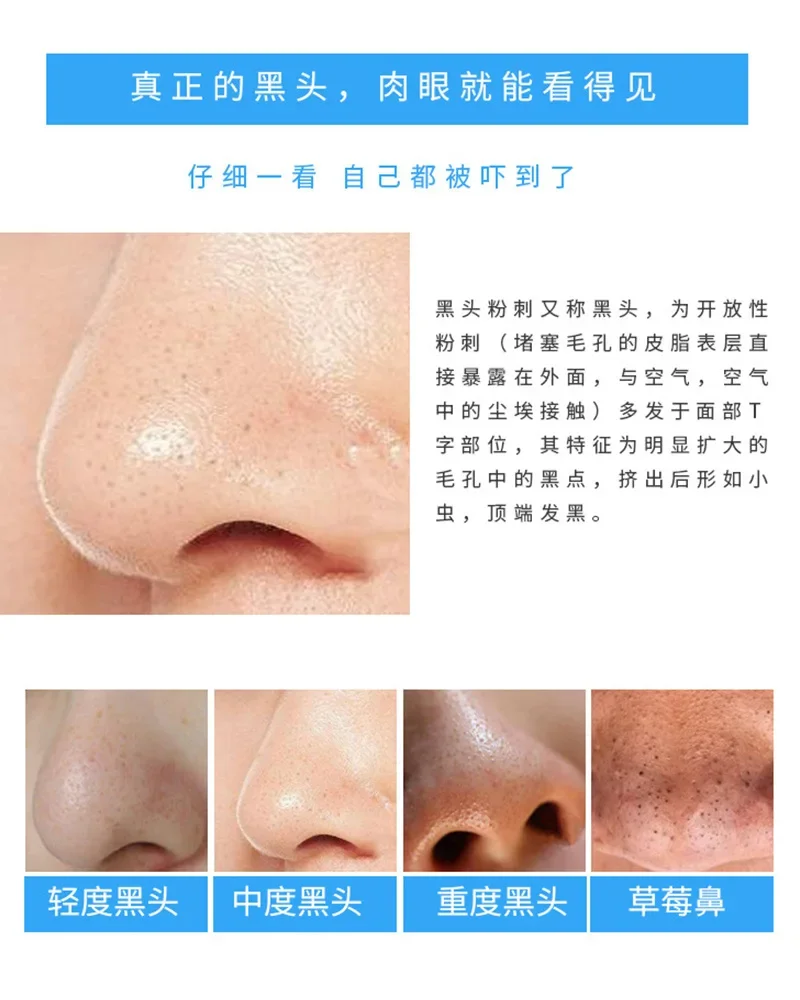 แผ่นลอกสิวเสี้ยนถ่านไม้ไผ่ 30  - Charcoal Pore Strip บทวิจารณ์และราคา