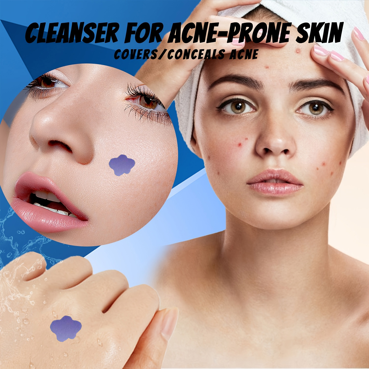 แผ่นแปะสิวไมโครนีดเดิล 232 ชิ้ - Skincare You บทวิจารณ์และราคา