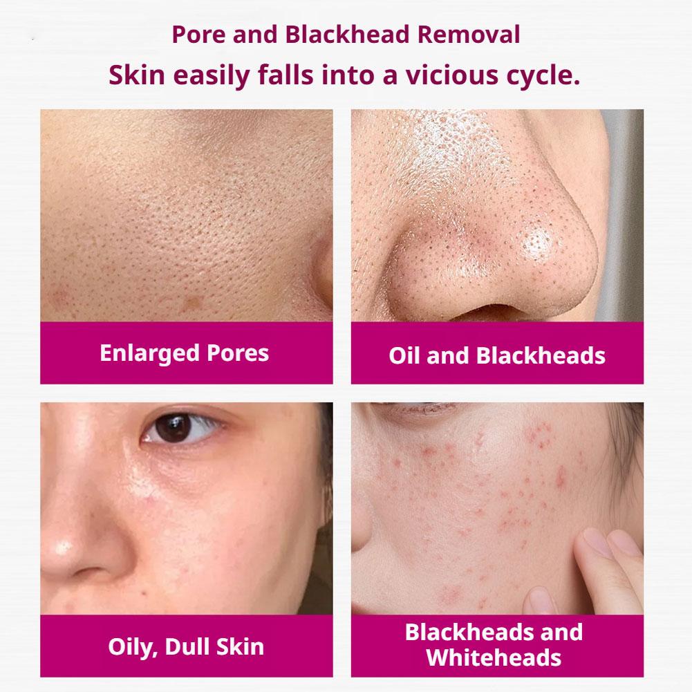 เซรั่มกรดซาลิไซลิกกระชับรูขุมข - Glycolic Acid Exfoliant บทวิจารณ์และราคา