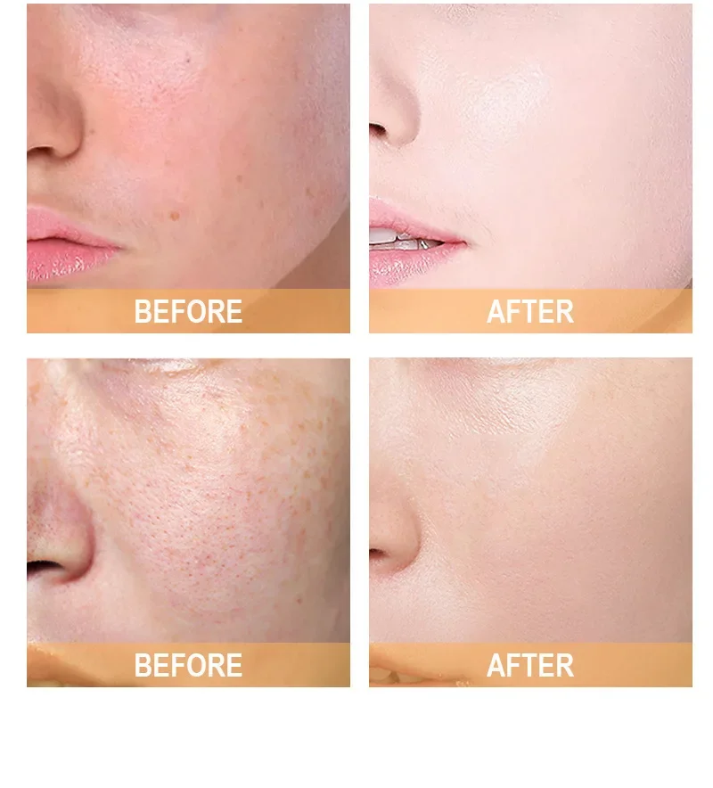 โทนเนอร์กรดไกลโคลิก 7% 240 มล. - Glycolic Acid Exfoliant บทวิจารณ์และราคา